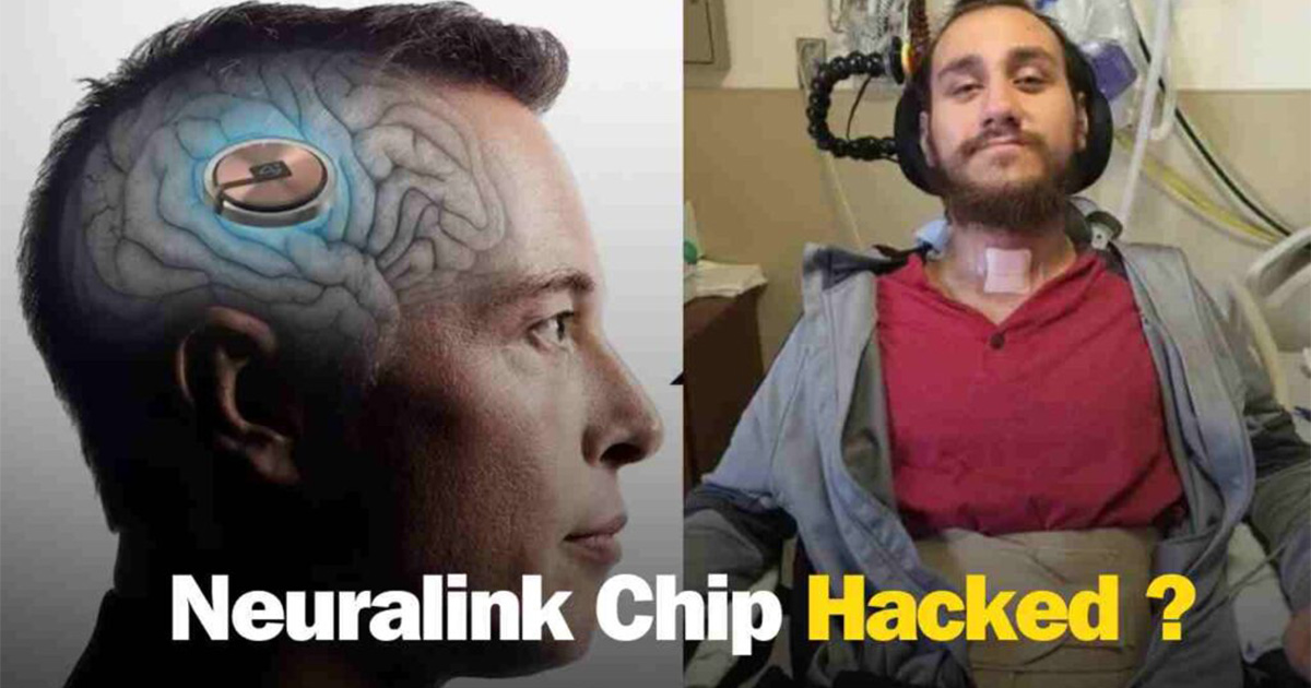 Neuralink Chip